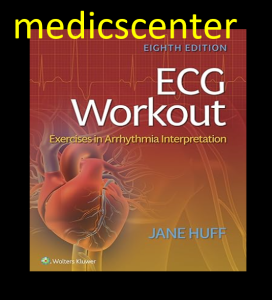 ECG Workout: Exercises in Arrhythmia Interpretation pdf