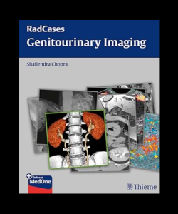 Radcases Genitourinary Imaging PDF