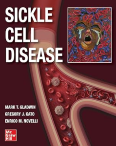 Sickle Cell Disease PDF