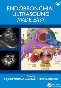 Endobronchial Ultrasound Made Easy PDF