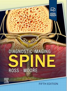 Diagnostic Imaging: Spine 5th Edition PDF