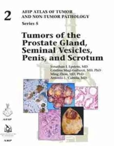 Tumors of the Prostate Gland Seminal Vesicles and Scrotumn