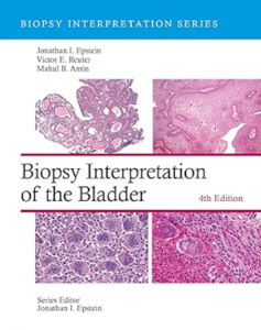 Biopsy Interpretation of the Bladder 4th Edition PDF
